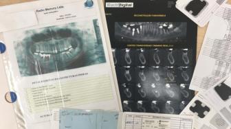 O corpo, identificado como sendo de Igor Rodrigues da Silva, foi encontrado totalmente carbonizado nessa sexta-feira, 12, às margens da rodovia TO-040.