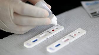 Trabalho é feito pelo Instituto para a Investigação Biotecnológica.