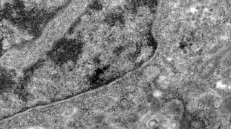 Cientistas correm para decifrar genoma de vírus com 50 mutações.
