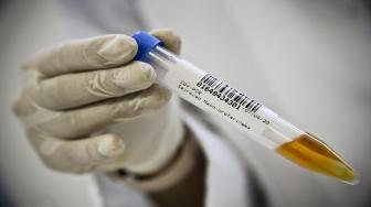 O novo boletim retoma a margem para novas altas para os próximos dias, devido o número de casos suspeitos e pessoa sendo monitoradas estarem inflados.