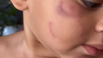 Incidente na Creche Municipal Irmã Evarista Viel gera indignação entre os pais e leva a manifestação oficial da prefeitura.