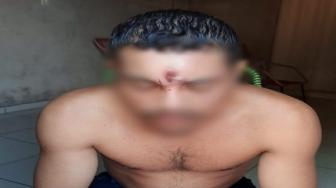 A Polícia Militar e o Samu só foram chamados depois que a mãe dele acordou e viu manchas de sangue nas roupas do filho. Após ser baleado, jovem abandonou moto e foi andando para casa.
