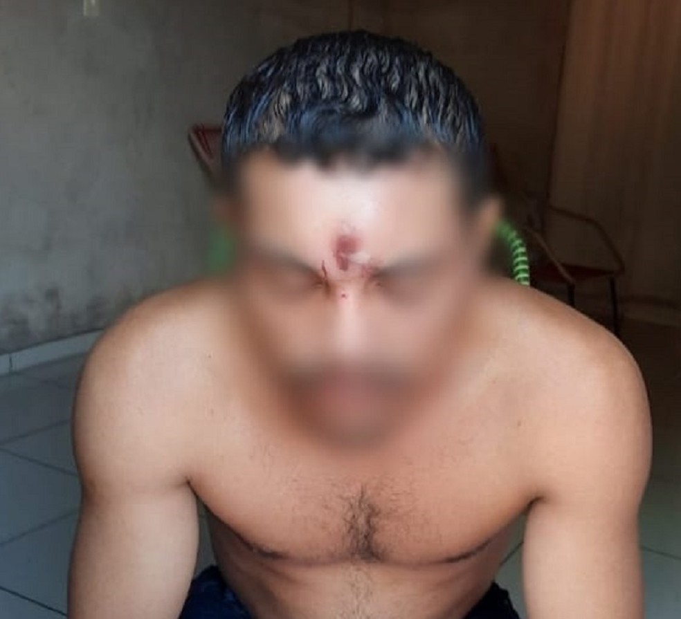 Homem levou tiro na testa e sobreviveu em Araguaína — Foto: Reprodução/Redes sociais