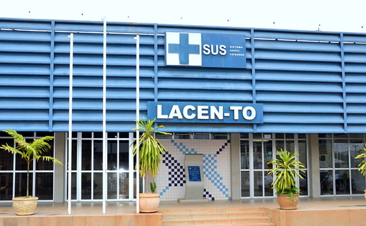 Lacen/TO envia semanalmente amostras à Fiocruz e conta ainda com parceria com a UFT. — Foto: André Araújo/Governo do Tocantins